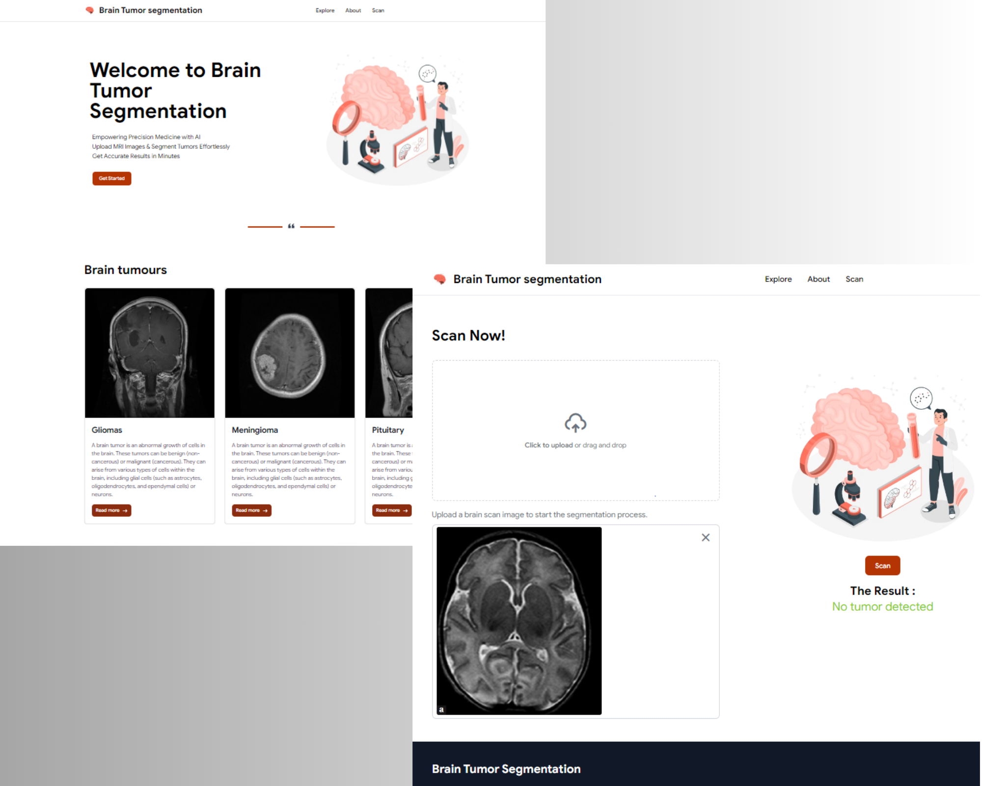 Brain Tumor Segmentation