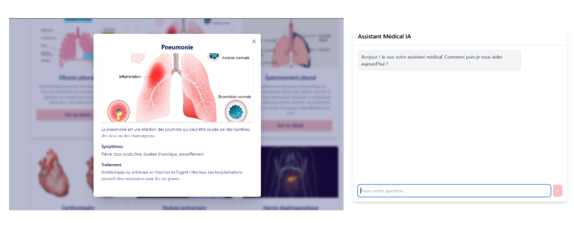 Lung Disease Detection